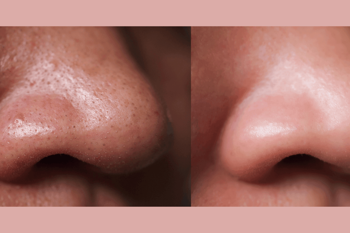 Gymsegbë - Ultra-Advanced Anti-Aging Daily Resurfacing Pads