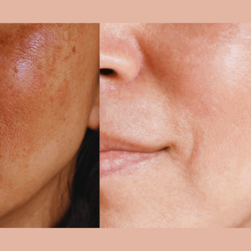 Gymsegbë - Ultra-Advanced Anti-Aging Daily Resurfacing Pads